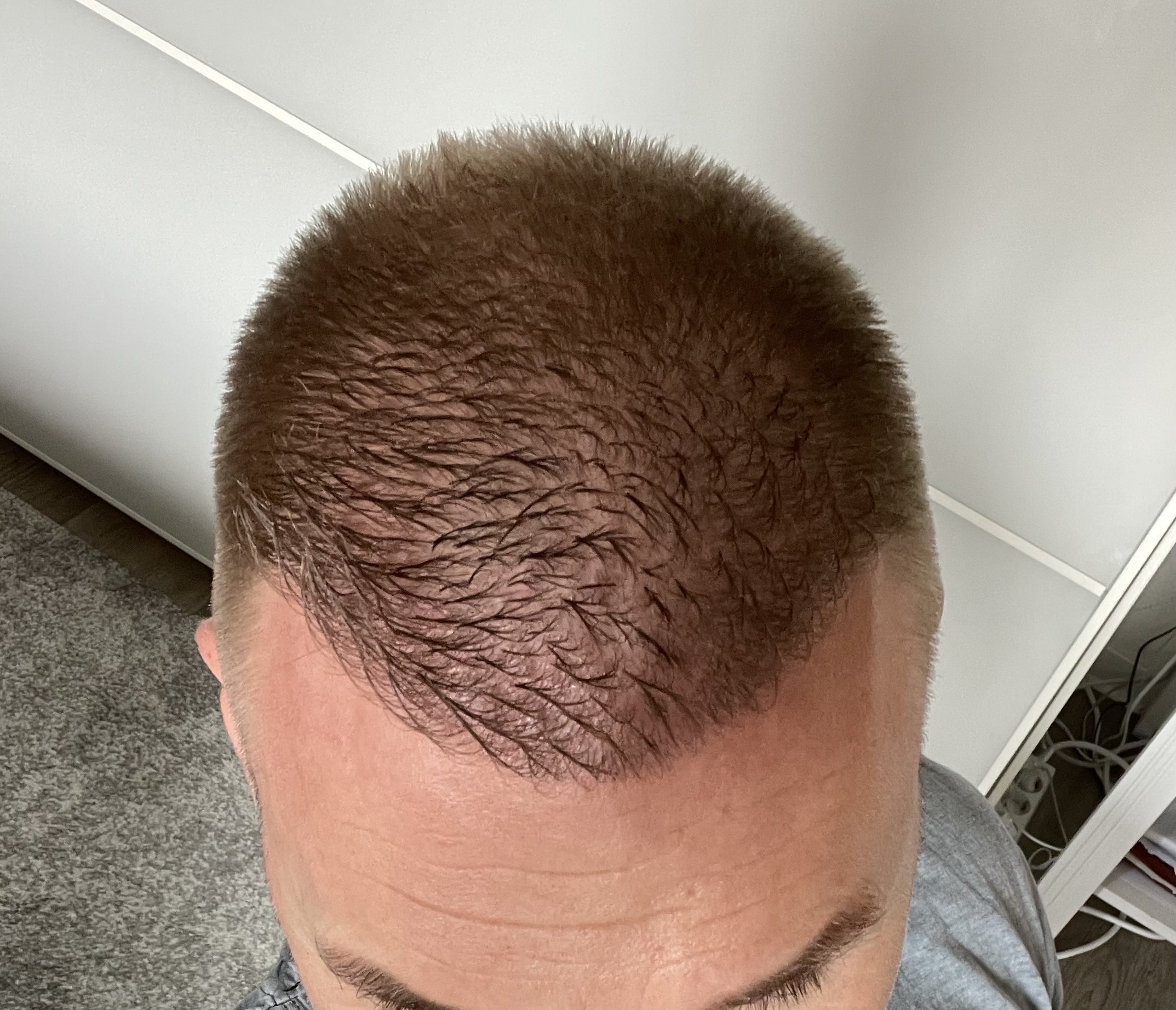 /foren/transplant/index.php/fa/52940/0/