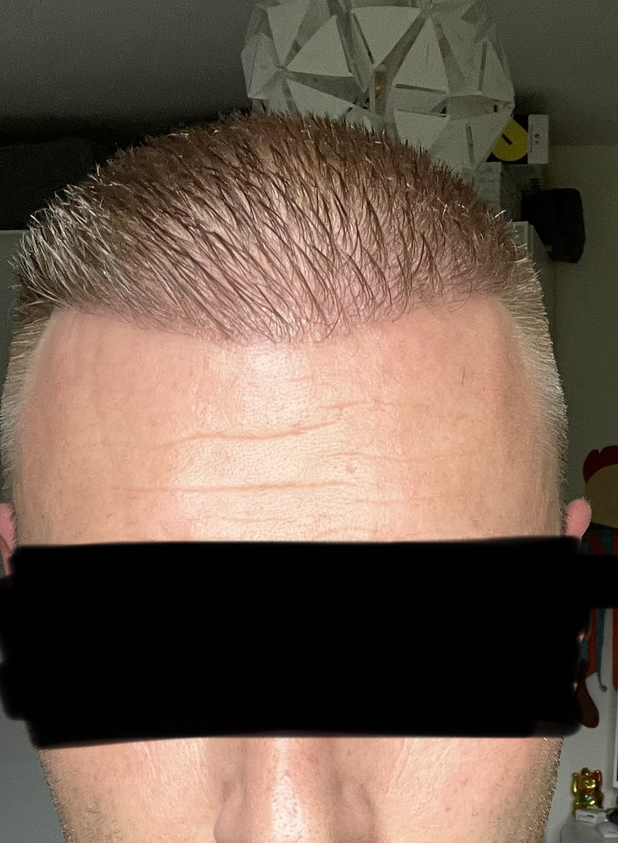 /foren/transplant/index.php/fa/52944/0/