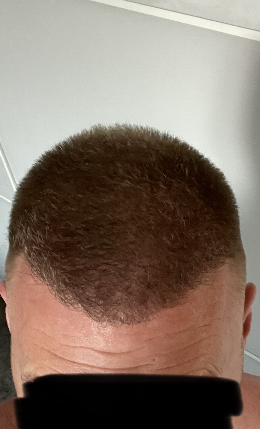 /foren/transplant/index.php/fa/52979/0/