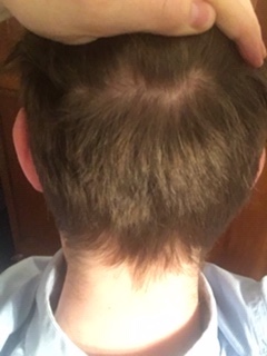 /foren/transplant/index.php/fa/53051/0/