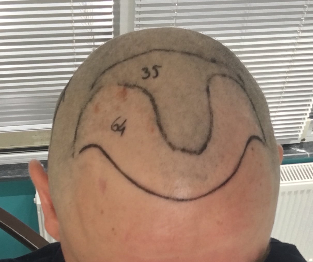 /foren/transplant/index.php/fa/53054/0/