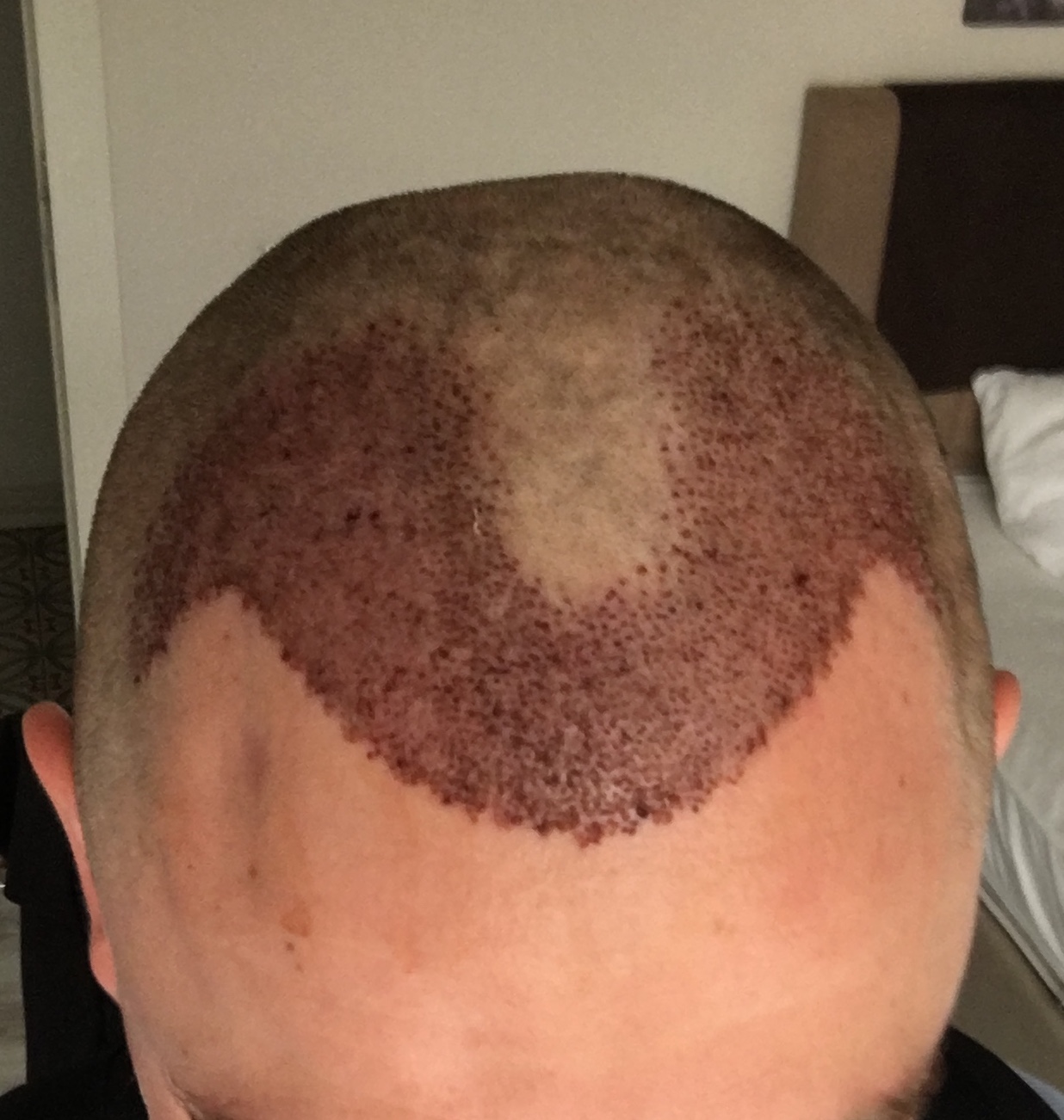 /foren/transplant/index.php/fa/53055/0/