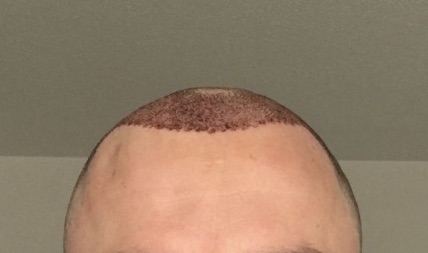 /foren/transplant/index.php/fa/53056/0/