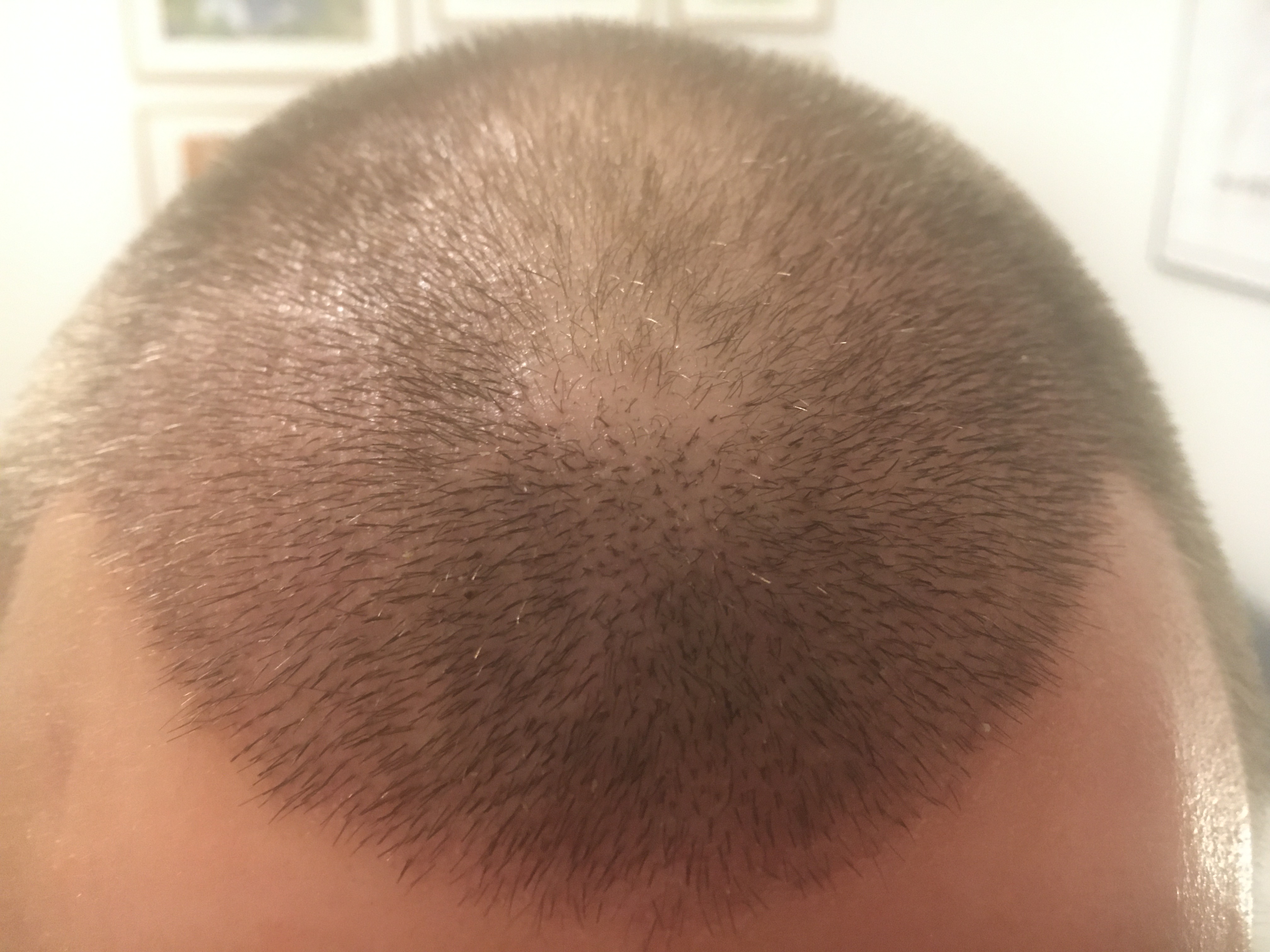 /foren/transplant/index.php/fa/53058/0/