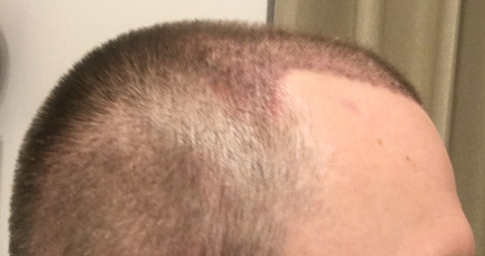 /foren/transplant/index.php/fa/53059/0/