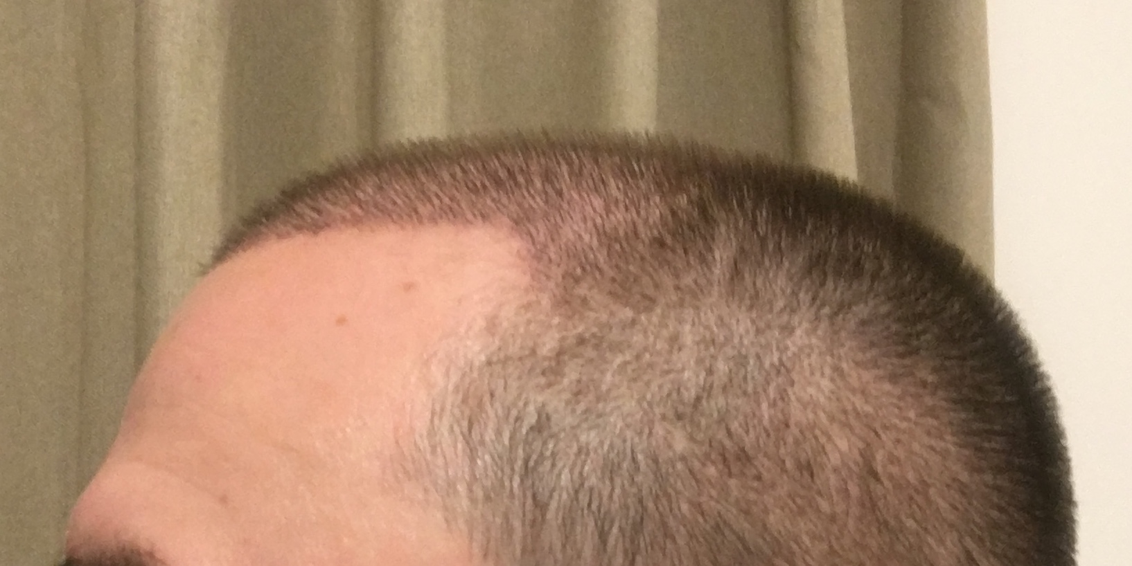 /foren/transplant/index.php/fa/53060/0/