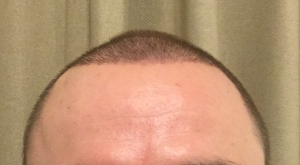 /foren/transplant/index.php/fa/53061/0/