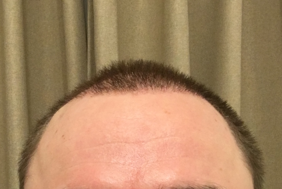 /foren/transplant/index.php/fa/53069/0/