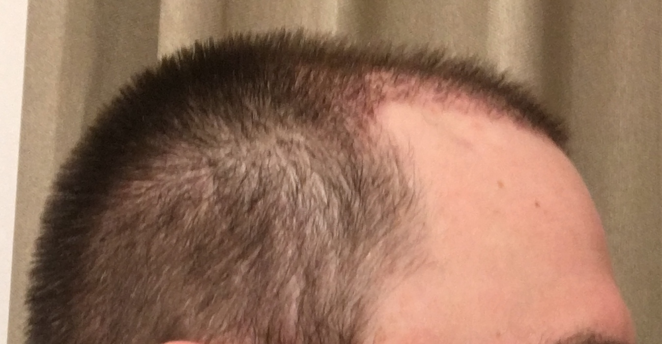 /foren/transplant/index.php/fa/53070/0/