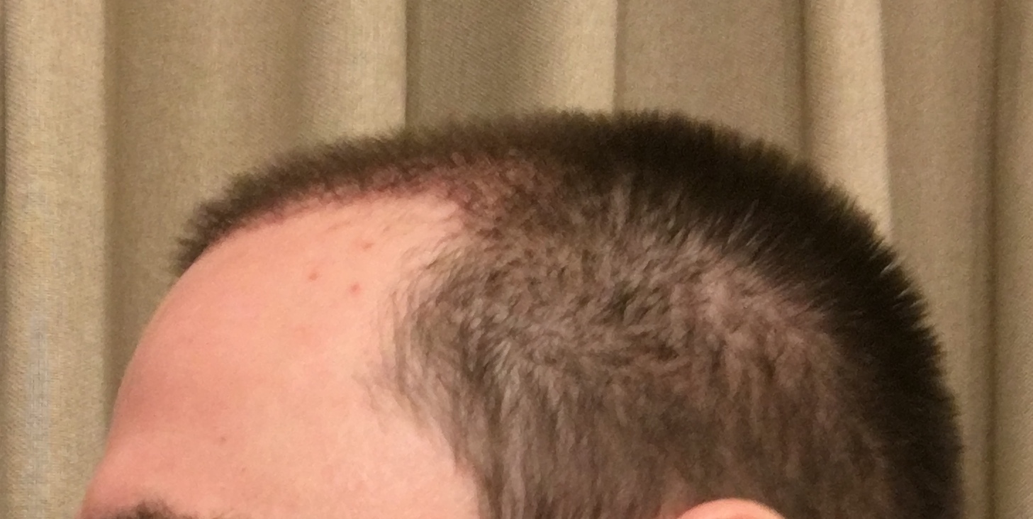 /foren/transplant/index.php/fa/53071/0/