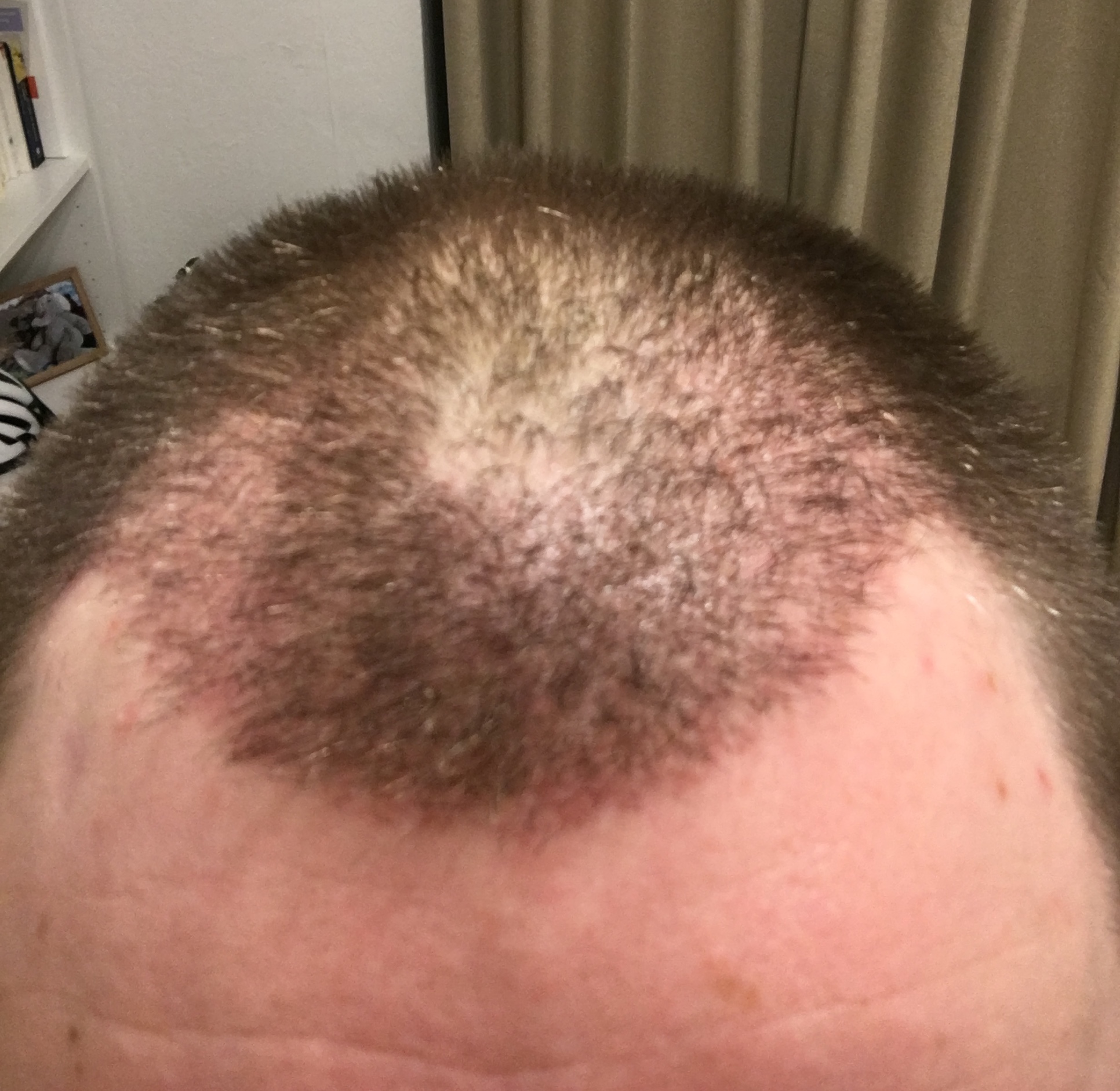 /foren/transplant/index.php/fa/53072/0/