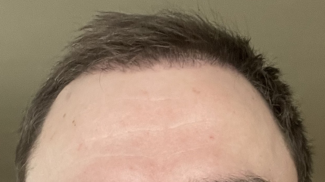 /foren/transplant/index.php/fa/53073/0/