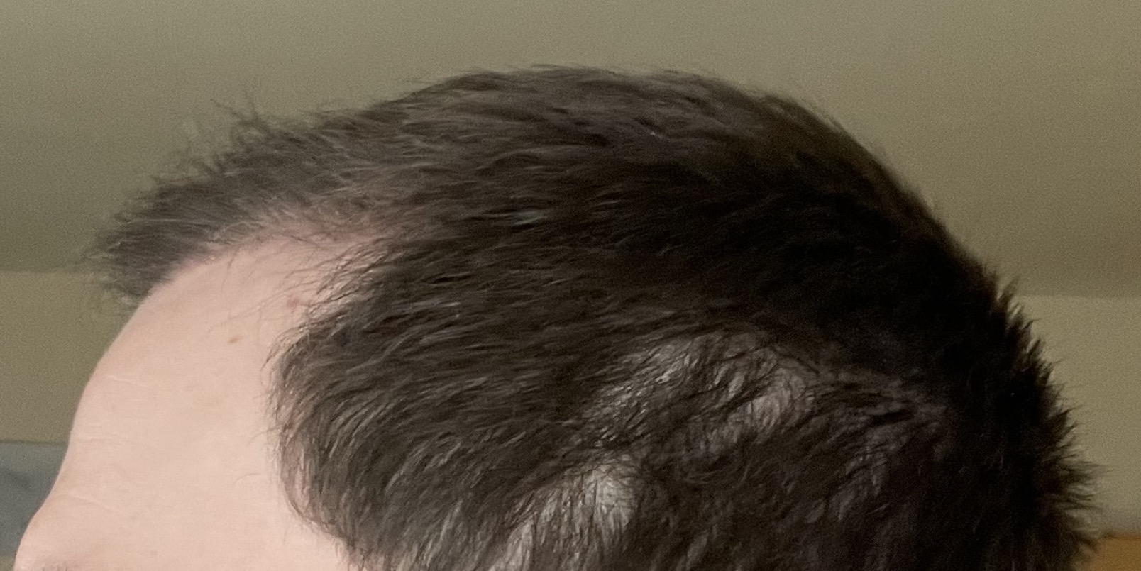 /foren/transplant/index.php/fa/53074/0/