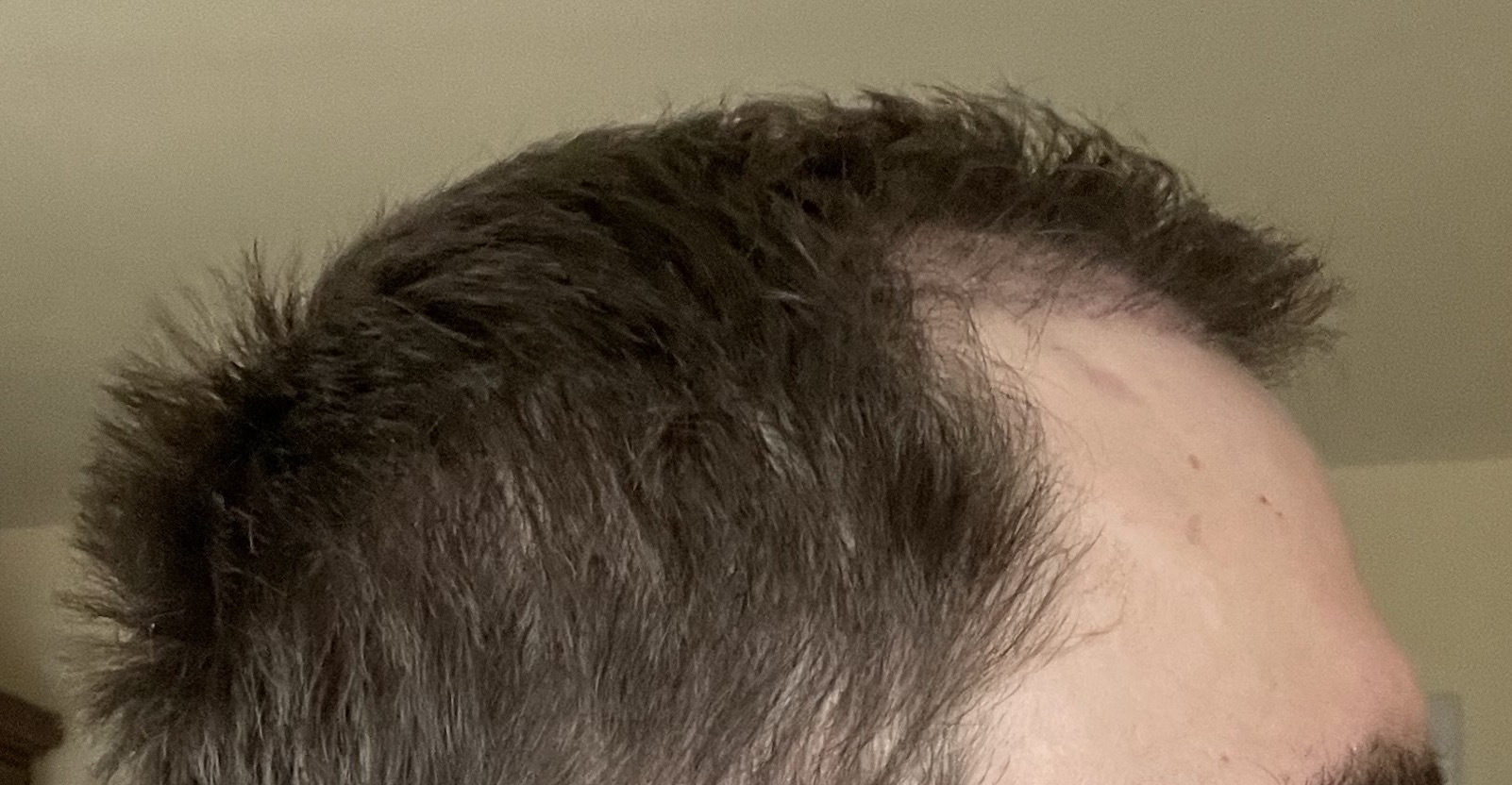 /foren/transplant/index.php/fa/53075/0/