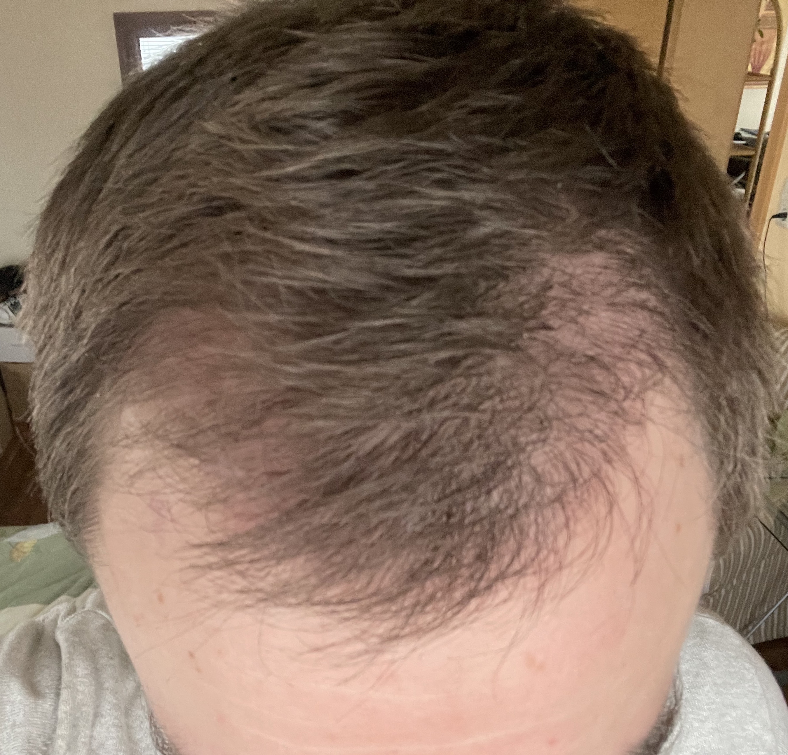 /foren/transplant/index.php/fa/53077/0/