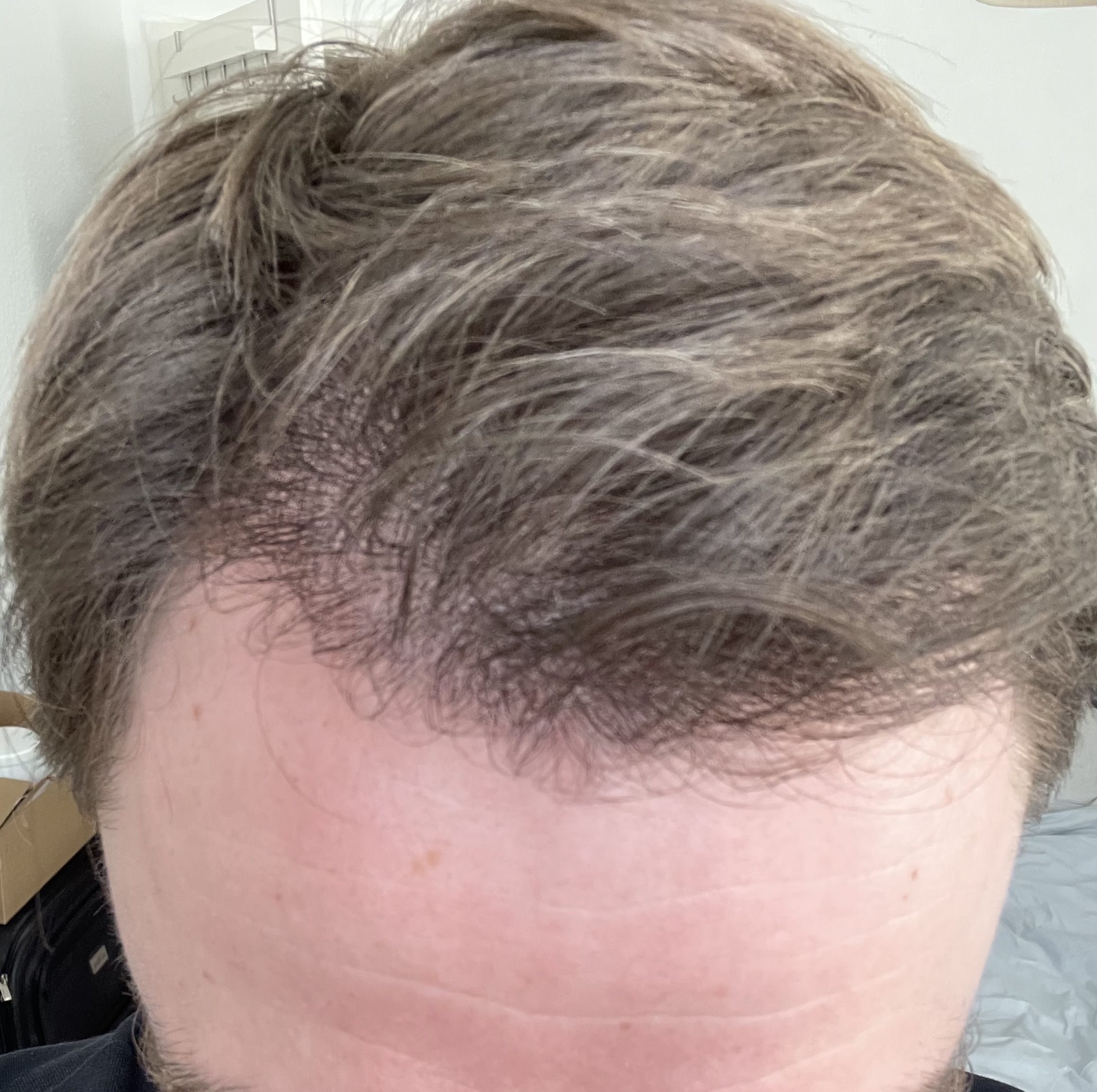 /foren/transplant/index.php/fa/53079/0/