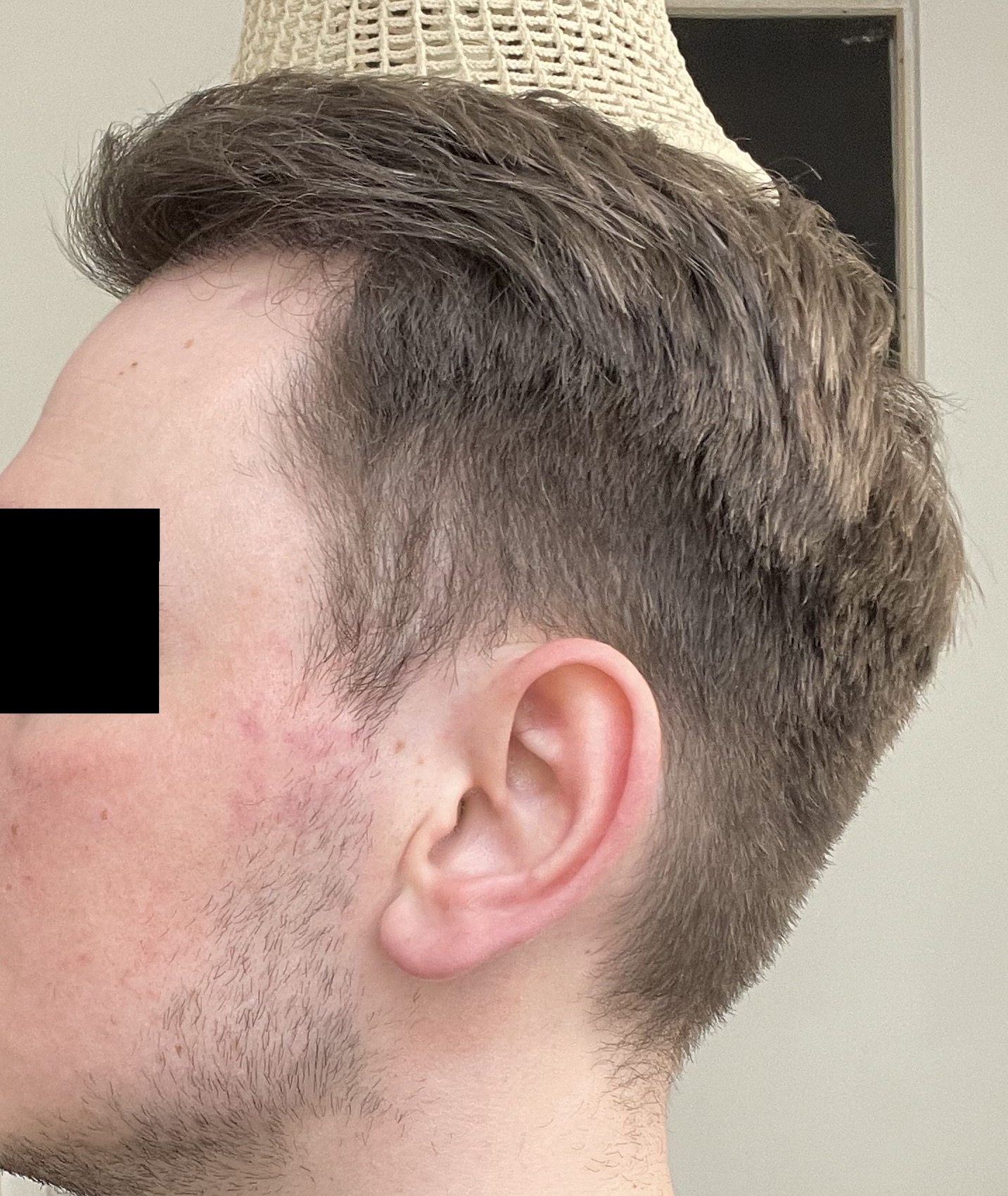 /foren/transplant/index.php/fa/53080/0/