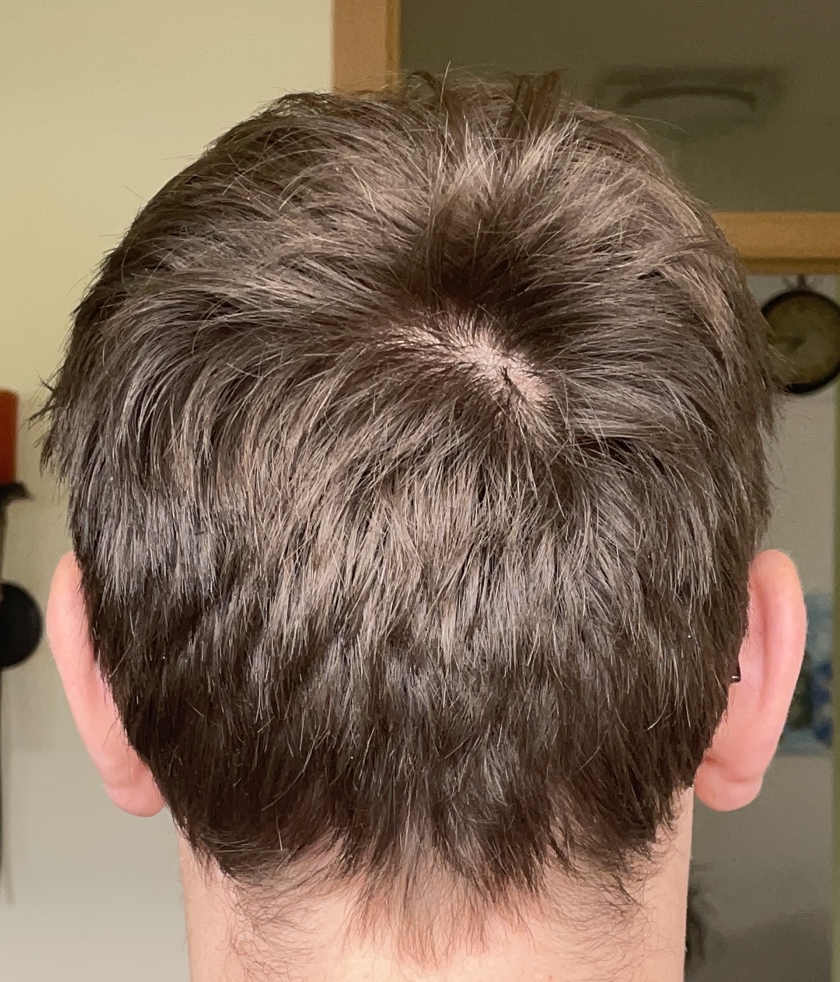 /foren/transplant/index.php/fa/53083/0/