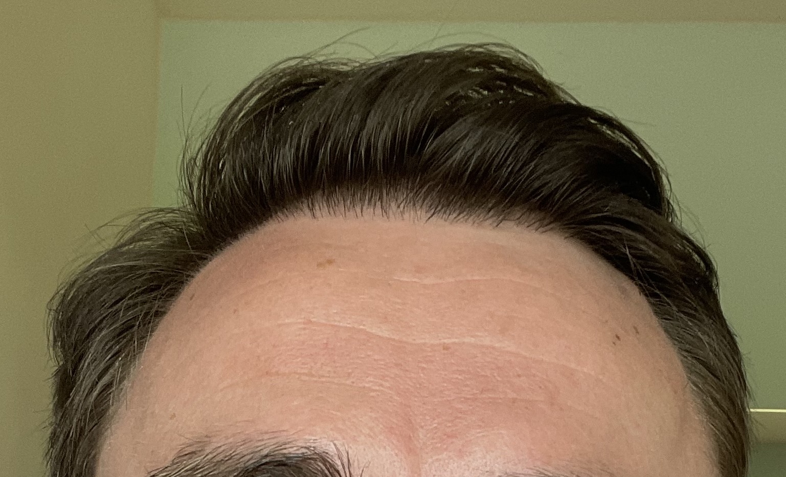 /foren/transplant/index.php/fa/53084/0/