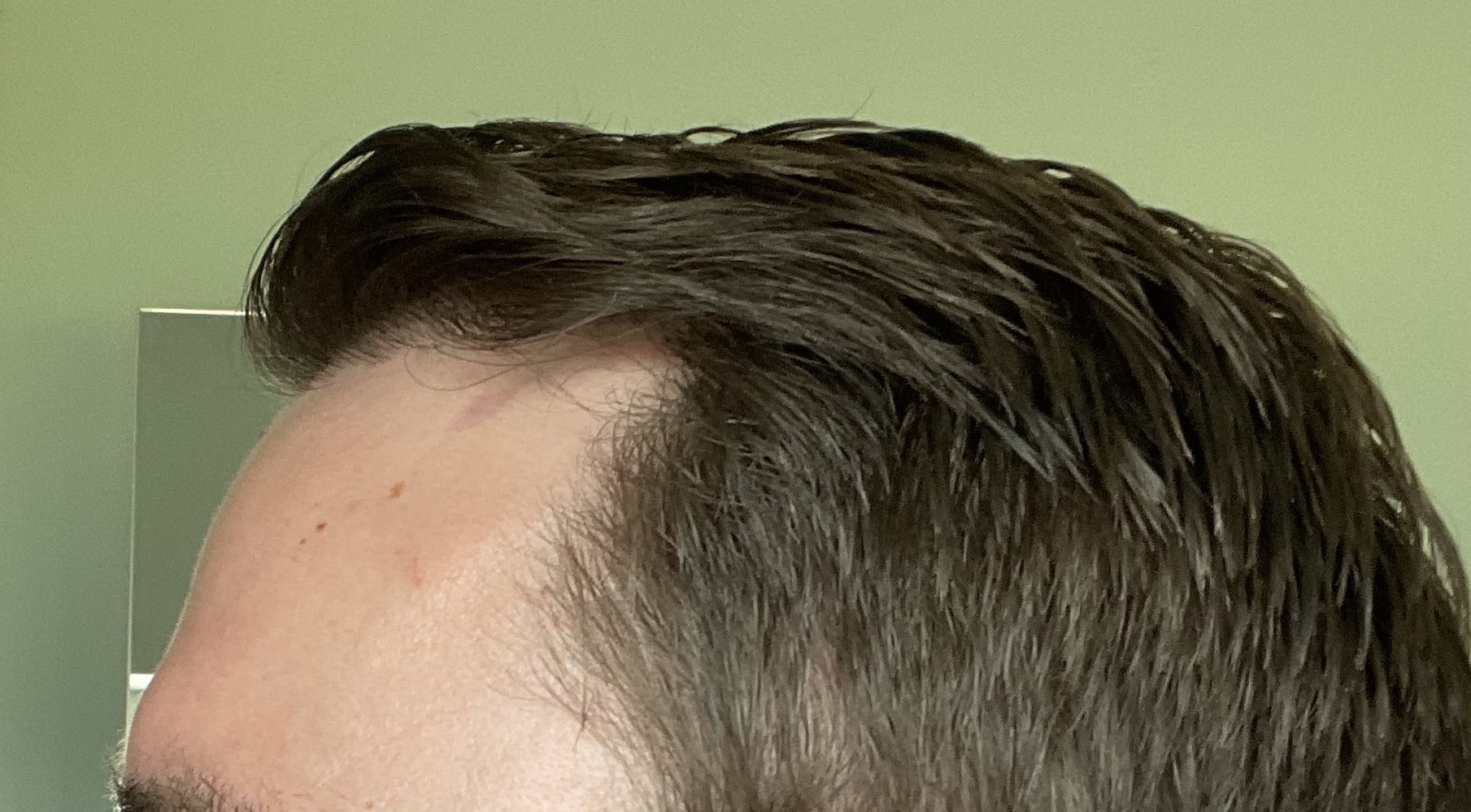 /foren/transplant/index.php/fa/53087/0/