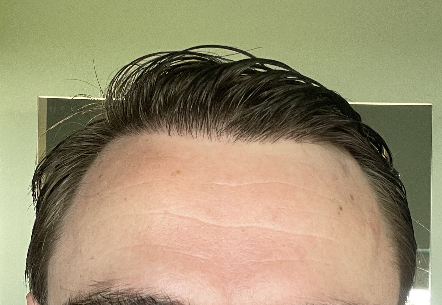 /foren/transplant/index.php/fa/53088/0/