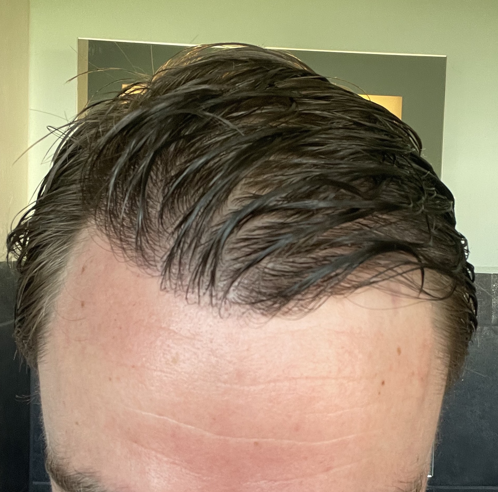 /foren/transplant/index.php/fa/53089/0/