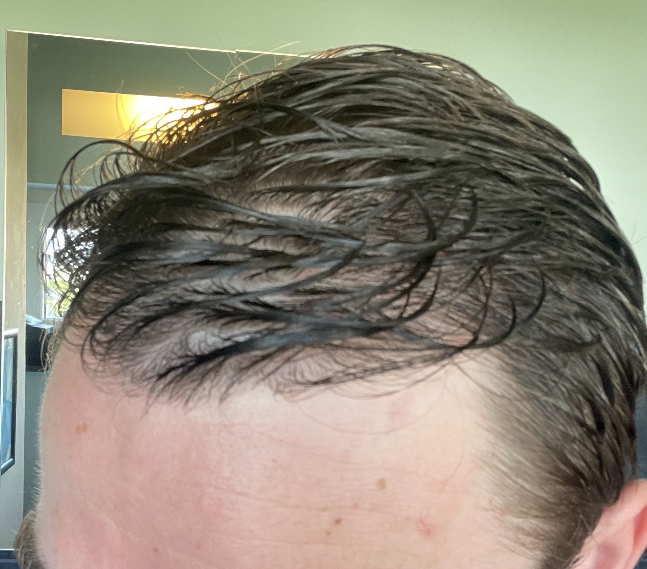 /foren/transplant/index.php/fa/53091/0/