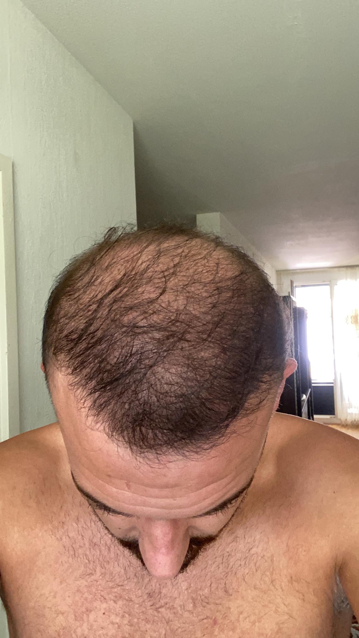 /foren/transplant/index.php/fa/53123/0/