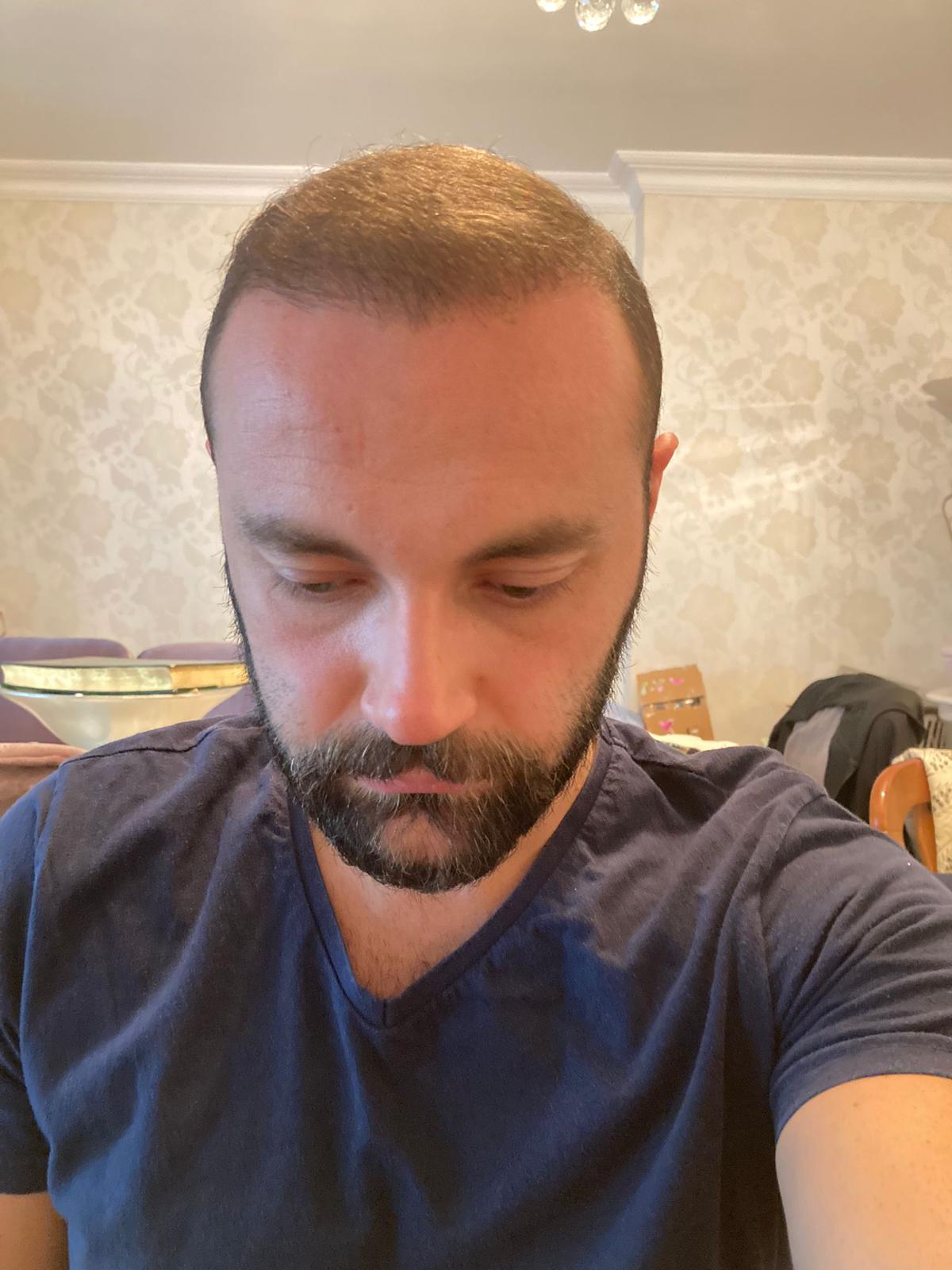 /foren/transplant/index.php/fa/53124/0/