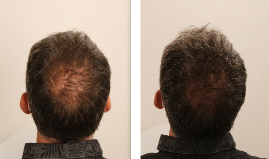 /foren/transplant/index.php/fa/53132/0/