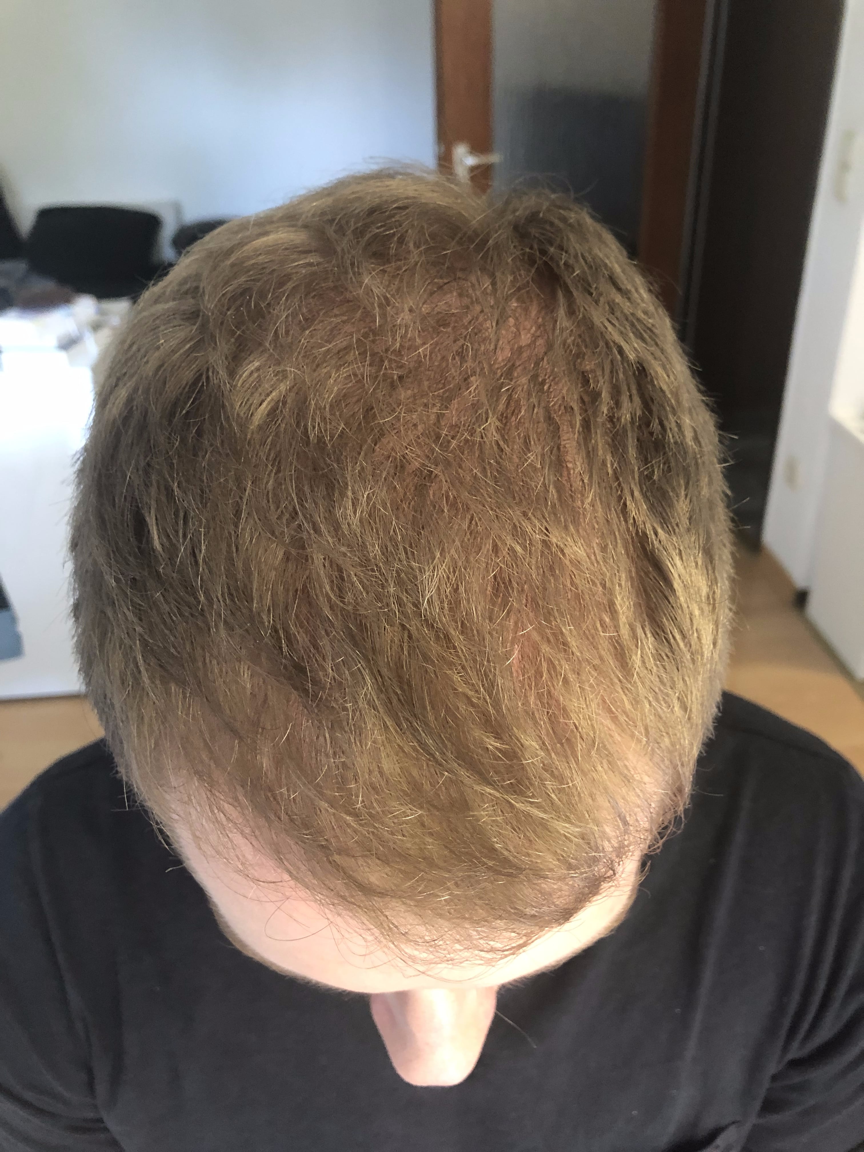 /foren/transplant/index.php/fa/53152/0/