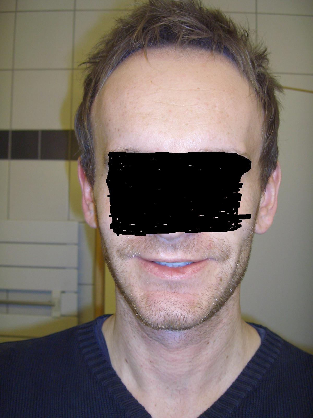 index.php/fa/5318/0/