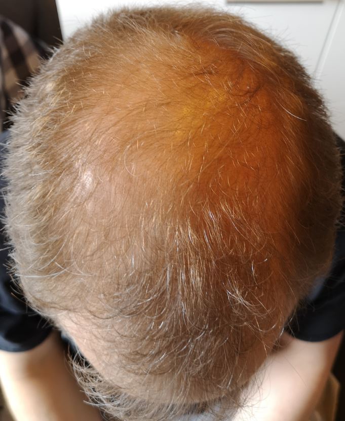 /foren/transplant/index.php/fa/53205/0/