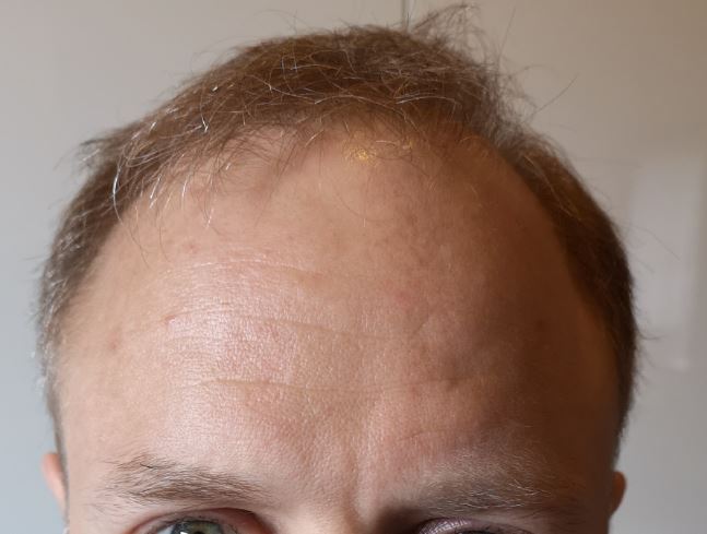 /foren/transplant/index.php/fa/53207/0/