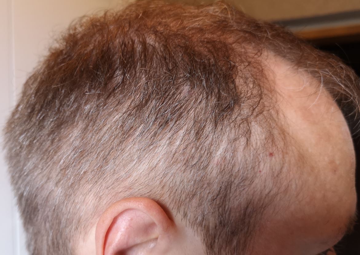 /foren/transplant/index.php/fa/53208/0/