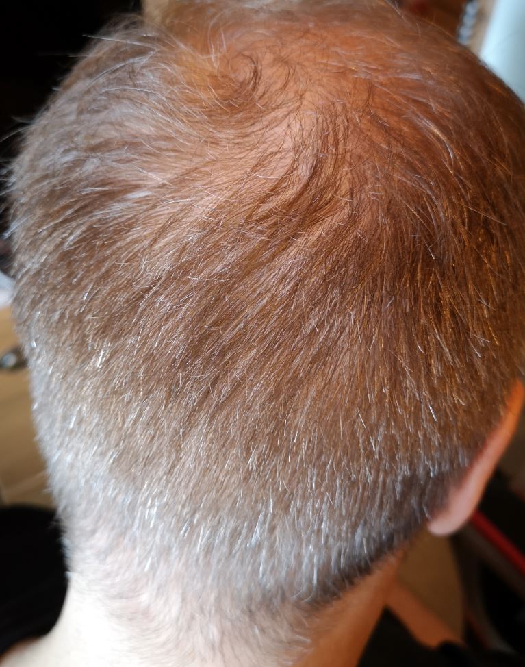 /foren/transplant/index.php/fa/53209/0/