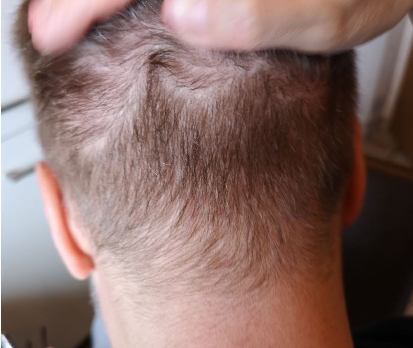 /foren/transplant/index.php/fa/53210/0/