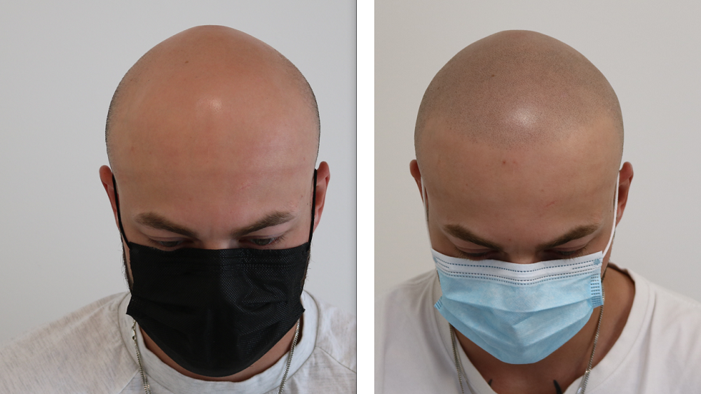 /foren/transplant/index.php/fa/53233/0/