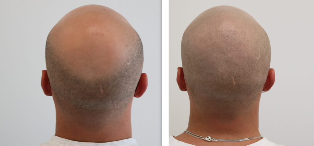 /foren/transplant/index.php/fa/53234/0/