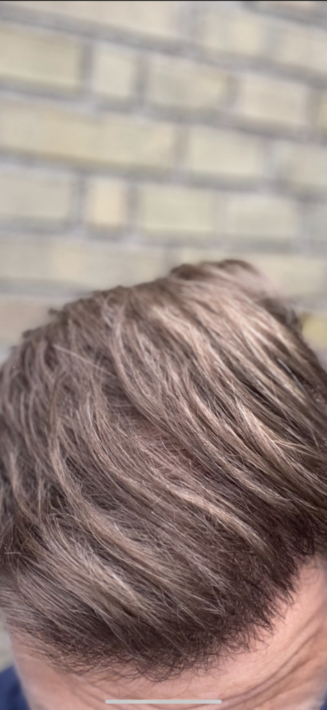 /foren/transplant/index.php/fa/53288/0/