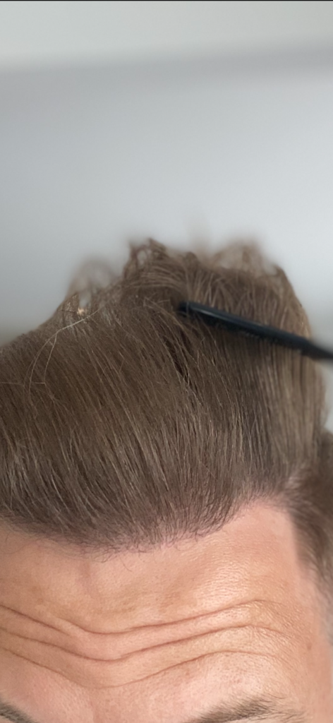 /foren/transplant/index.php/fa/53290/0/