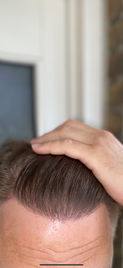 /foren/transplant/index.php/fa/53291/0/