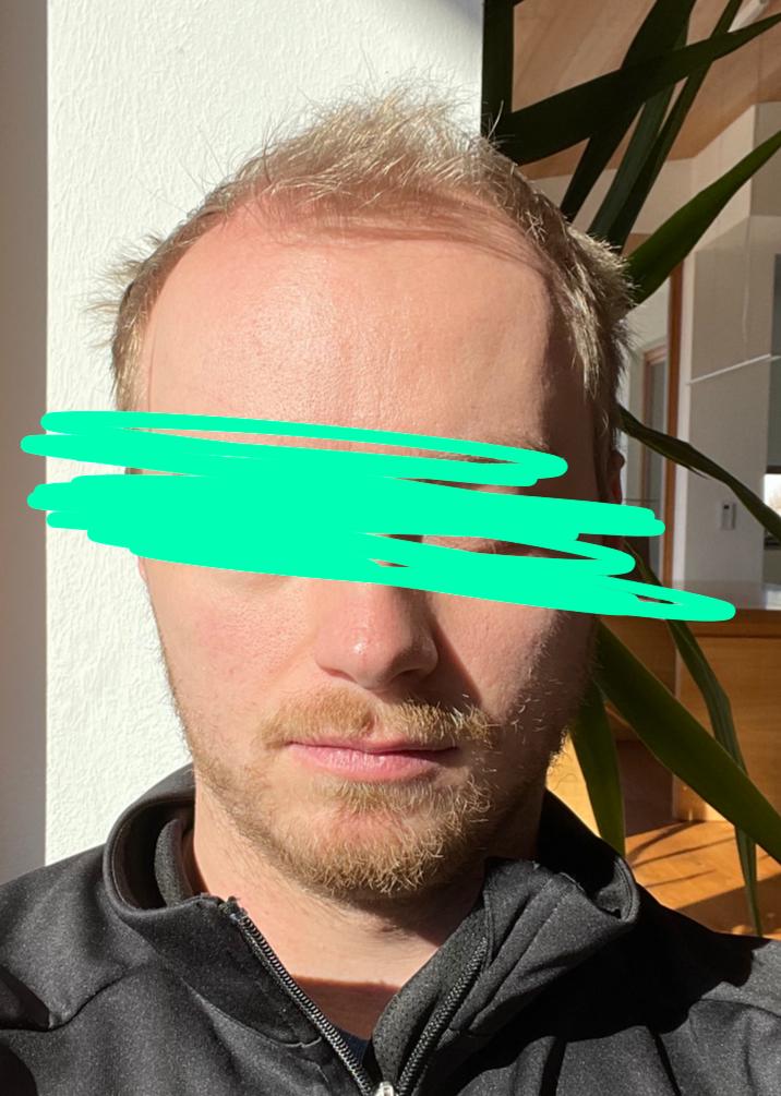 /foren/transplant/index.php/fa/53293/0/