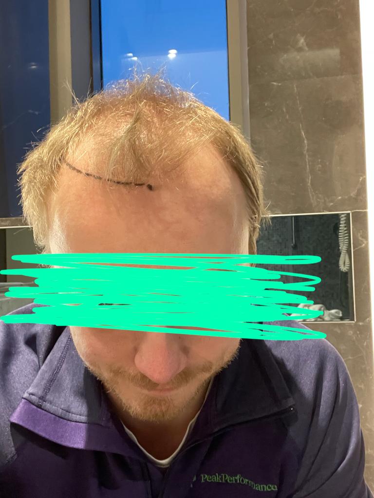 /foren/transplant/index.php/fa/53294/0/