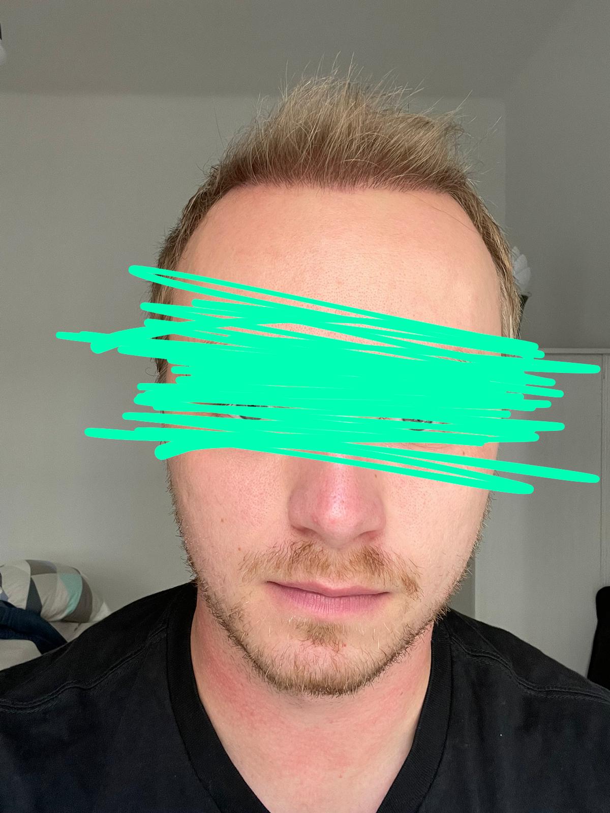 /foren/transplant/index.php/fa/53295/0/