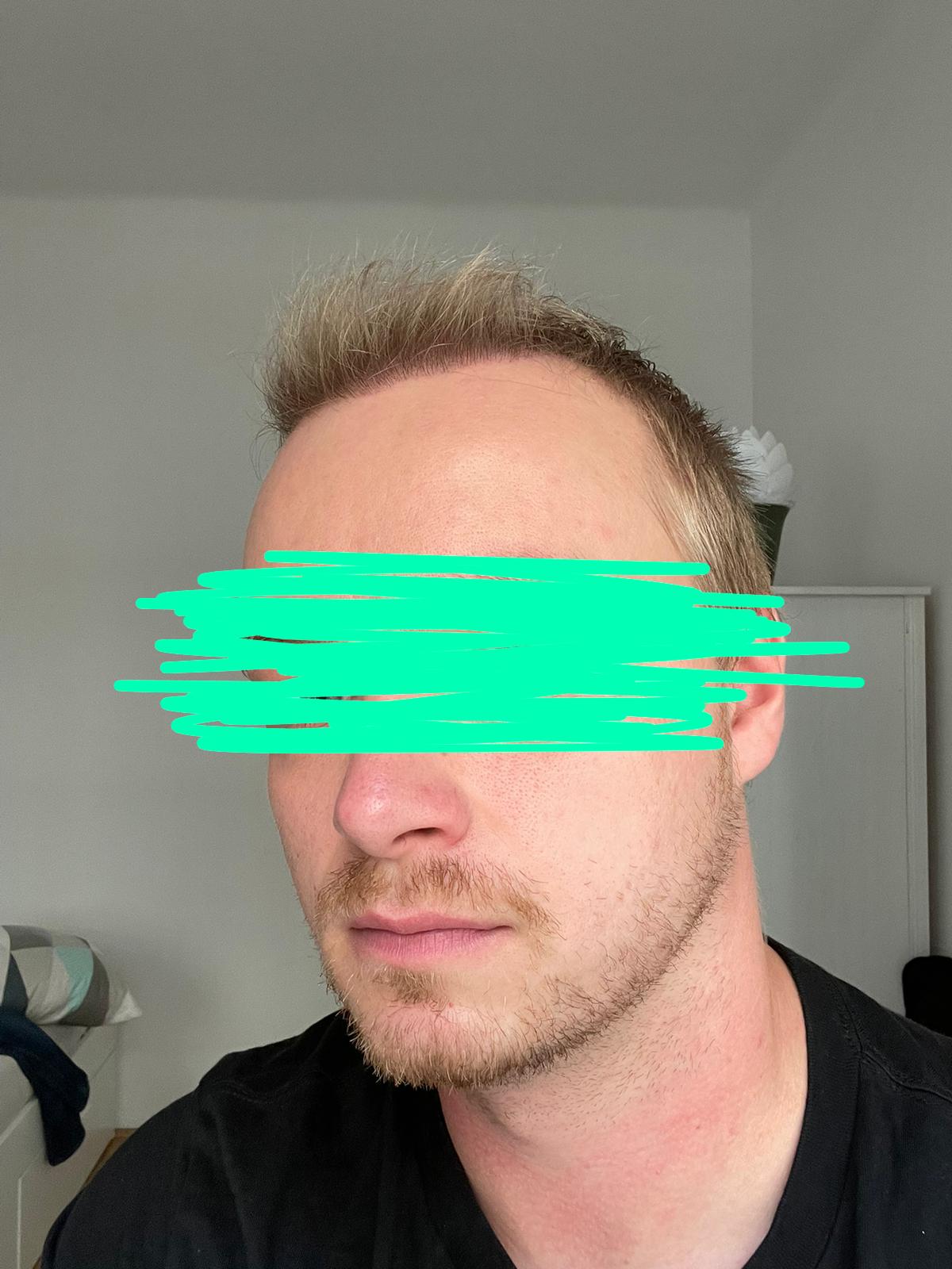 /foren/transplant/index.php/fa/53296/0/