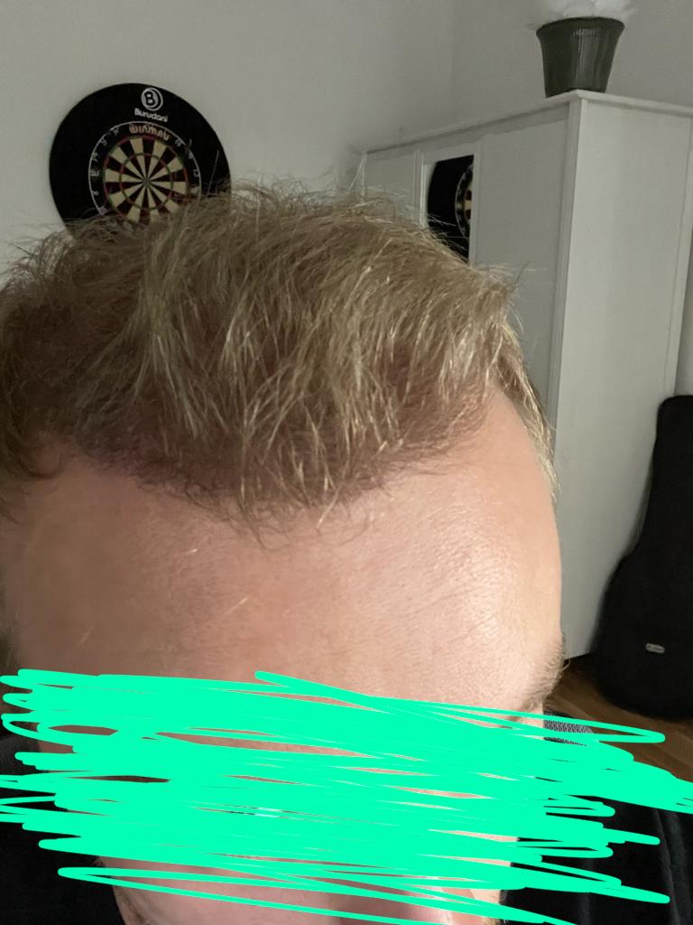 /foren/transplant/index.php/fa/53297/0/