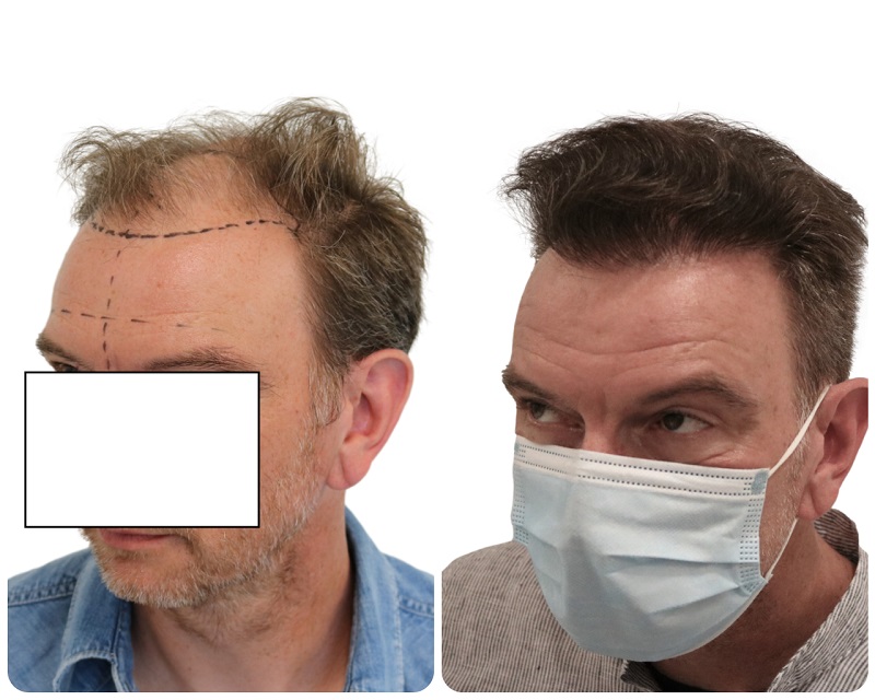 /foren/transplant/index.php/fa/53404/0/