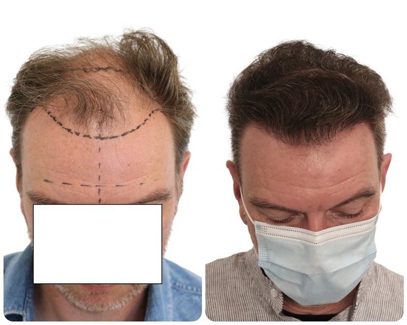 /foren/transplant/index.php/fa/53406/0/