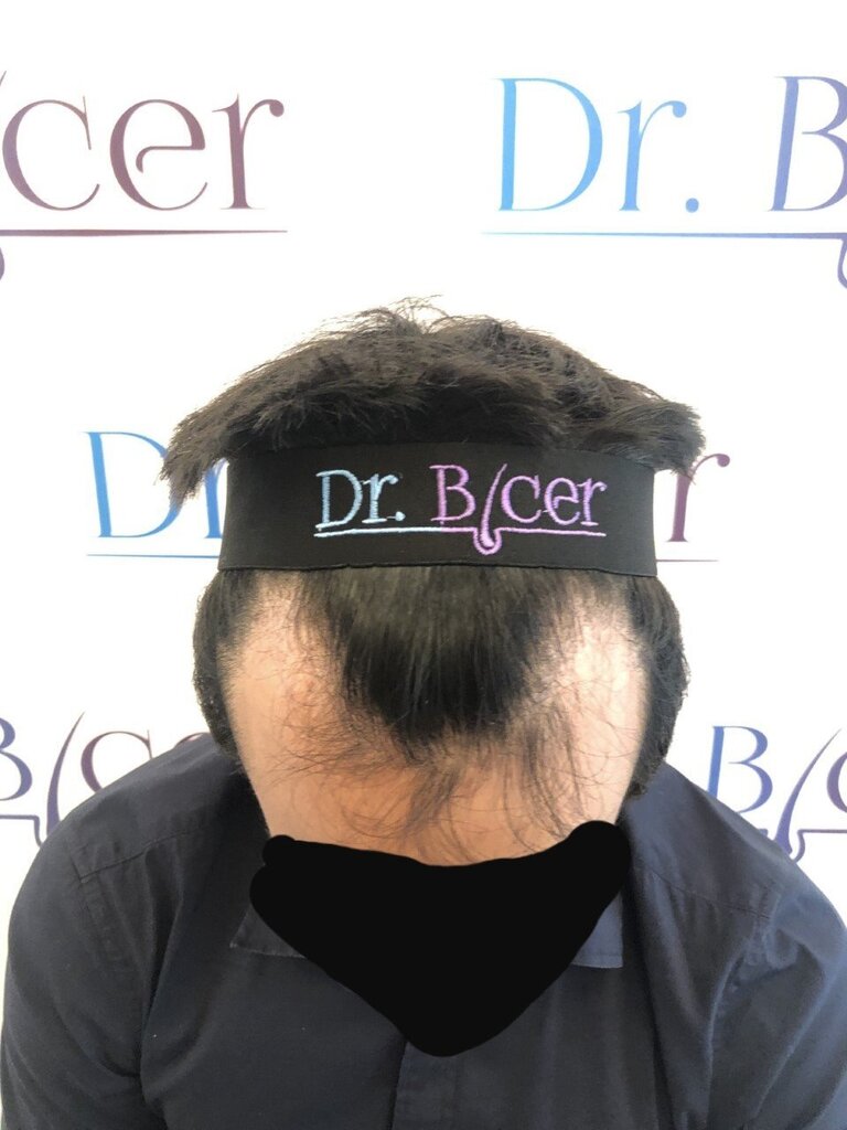 /foren/transplant/index.php/fa/53455/0/